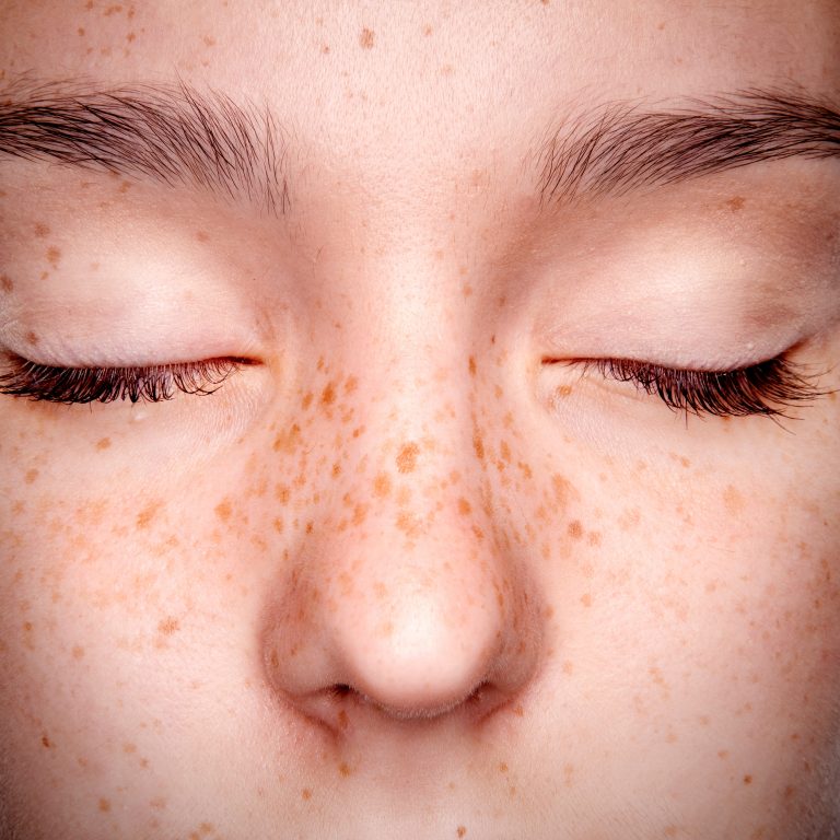 Microblading — Taches de Rousseur