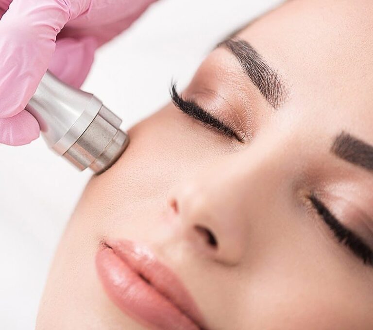 Microdermabrasion