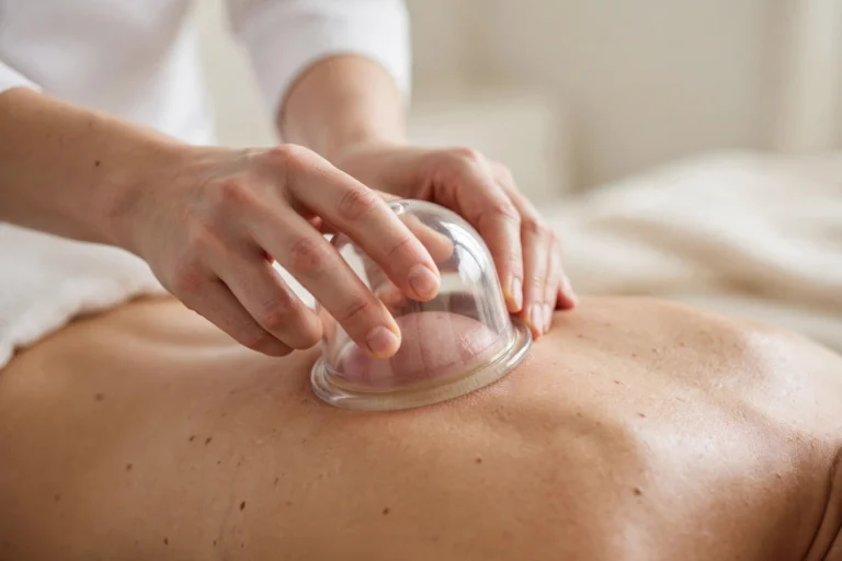 Thérapie par Ventouses (Cupping)