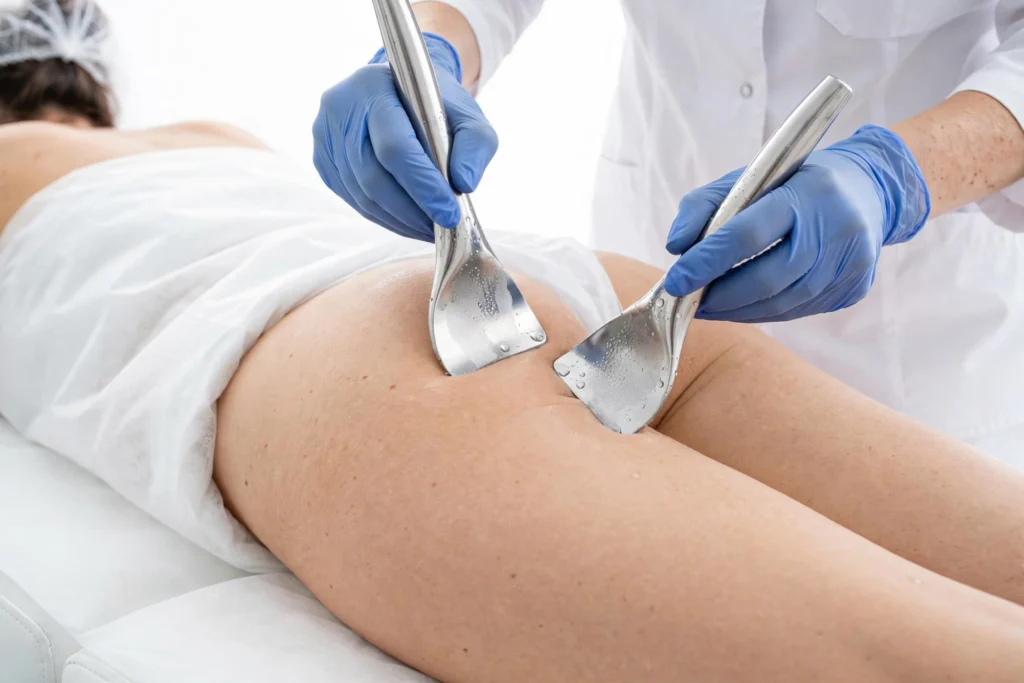 Formation esthétique BeyondSkin en pratique